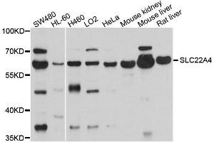 Western blot analysis of extracts of various cells, using SLC22A4 antibody. (SLC22A4 antibody)