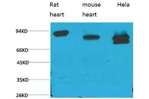 Western Blot (WB) analysis of 1) Rat Heart Tissue, 2)Mouse Heart Tissue, 3) HeLa with STAT3 Mouse Monoclonal Antibody diluted at 1:2000.