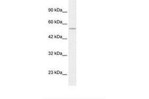 Image no. 1 for anti-Egl-9 Family Hypoxia Inducible Factor 1 (EGLN1) (C-Term) antibody (ABIN202496) (EGLN1 antibody  (C-Term))