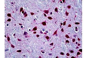 Anti-SFPQ antibody IHC of human brain, cortex. (SFPQ antibody  (AA 269-362))