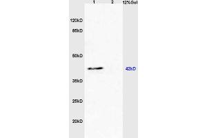 Lane 1: mouse heart lysates Lane 2: mouse liver lysates probed with Anti BAI2/Brain Specific Angiogenesis Inhibitor 2 Polyclonal Antibody, Unconjugated (ABIN872819) at 1:200 in 4 °C.