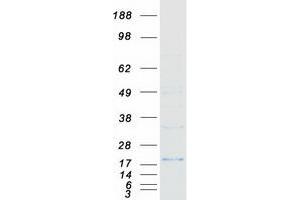 p21 Protein (Transcript Variant 2) (Myc-DYKDDDDK Tag)