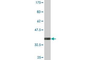 Western Blot detection against Immunogen (36. (UGT2B4 antibody  (AA 25-124))