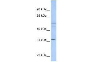 WB Suggested Anti-ZFYVE19 Antibody Titration:  0.