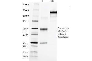 SDS-PAGE Analysis Purified AFP Mouse Monoclonal Antibody (C3). (alpha Fetoprotein antibody)