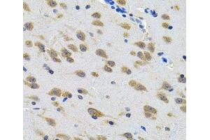 Immunohistochemistry of paraffin-embedded Rat brain using LGR6 Polyclonal Antibody at dilution of 1:100 (40x lens). (LGR6 antibody)