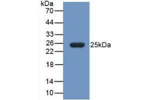 Detection of Recombinant FBLN1, Mouse using Monoclonal Antibody to Fibulin 1 (FBLN1) (Fibulin 1 antibody  (AA 399-578))