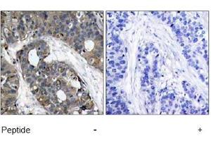 Image no. 1 for anti-Heat Shock 27kDa Protein 1 (HSPB1) (AA 80-84) antibody (ABIN197490) (HSP27 antibody  (AA 80-84))