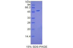 SDS-PAGE (SDS) image for Apolipoprotein A-V (APOA5) (AA 167-335) protein (His tag) (ABIN2120600)