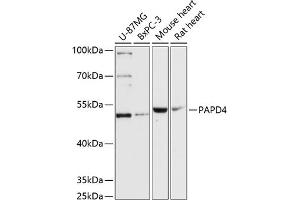 Western blot analysis of extracts of various cell lines, using P antibody (ABIN6132457, ABIN6145211, ABIN6145212 and ABIN6217164) at 1:3000 dilution. (PAPD4 antibody  (AA 1-300))