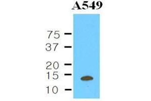 The Cell lysates of A549 (35 ug) were resolved by SDS-PAGE, transferred to nitrocellulose membrane and probed with anti-human CSTB (1:1000). (CSTB antibody  (AA 1-98))