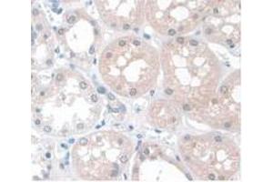 IHC-P analysis of Human Kidney Tissue, with DAB staining. (APOA1 antibody  (AA 122-267))