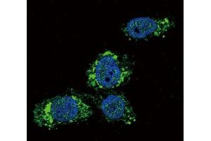 Immunofluorescence testing of human HepG2 cells with GCK antibody (green) and DAPI nuclear counterstain (blue). (GCK antibody  (AA 1-30))