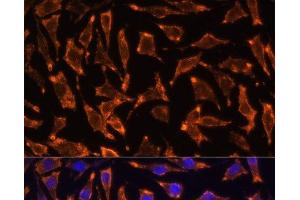 Immunofluorescence analysis of L929 cells using TNFRSF11A Polyclonal Antibody at dilution of 1:100 (40x lens). (TNFRSF11A antibody)
