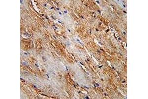 LC3II antibody immunohistochemistry analysis in formalin fixed and paraffin embedded human skeletal muscle. (LC3B antibody  (AA 74-106))