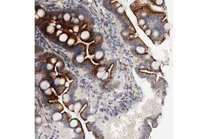 Immunohistochemical staining of human duodenum with FAM155A polyclonal antibody  shows strong granular cytoplasmic positivity in glandular cells. (FAM155A antibody)