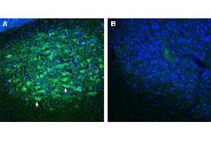Expression of SORCS2 in mouse deep cerebellar nuclei.