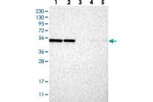 Western blot analysis of Lane 1: RT-4, Lane 2: U-251 MG, Lane 3: Human Plasma, Lane 4: Liver, Lane 5: Tonsil with C2orf30 polyclonal antibody . (C2orf30 antibody)