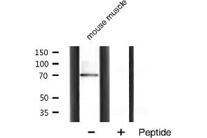 Western blot analysis of p70 S6 Kinase expression in mouse muscle tissue lysates,The lane on the right is treated with the antigen-specific peptide. (RPS6KB1 antibody  (Internal Region))