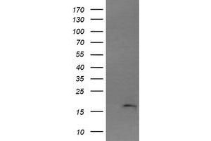 Image no. 1 for anti-Cancer/testis Antigen 1B (CTAG1B) antibody (ABIN1499900) (CTAG1B antibody)