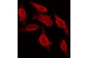ABIN6267001 staining MCF7 by IF/ICC.