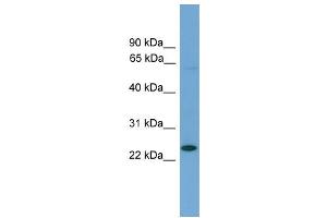 WB Suggested Anti-Ascl3 Antibody Titration: 0. (ASCL3 antibody  (Middle Region))