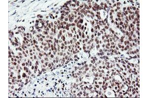 Image no. 2 for anti-Ring Finger Protein 113B (RNF113B) antibody (ABIN1500715) (RNF113B antibody)