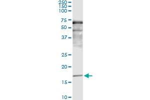 Immunoprecipitation of SNCA transfected lysate using anti-SNCA monoclonal antibody and Protein A Magnetic Bead , and immunoblotted with SNCA MaxPab rabbit polyclonal antibody. (SNCA antibody  (AA 31-140))