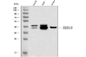 anti-Retinol Dehydrogenase 10 (All-Trans) (RDH10) (AA 1-341) antibody