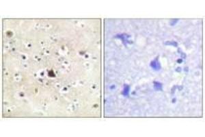 Immunohistochemical analysis of paraffin-embedded human brain tissue using GR (Ab-226) antibody. (Glucocorticoid Receptor antibody  (Ser226, Ser234, Ser246))