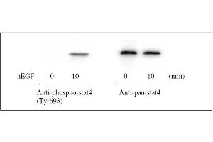 Western Blotting (WB) image for Signal Transducer and Activator of Transcription 4 (STAT4) ELISA Kit (ABIN1981841)