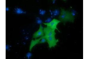 Immunofluorescence (IF) image for anti-Protein Kinase D2 (PKD2) antibody (ABIN1500412)