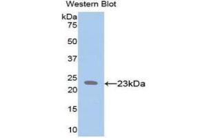 Western Blotting (WB) image for anti-Elastin (ELN) (AA 392-645) antibody (ABIN1858709) (Elastin antibody  (AA 392-645))