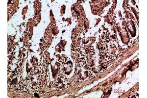 Immunohistochemical analysis of paraffin-embedded human-colon, antibody was diluted at 1:200 (IL17C antibody  (AA 81-130))