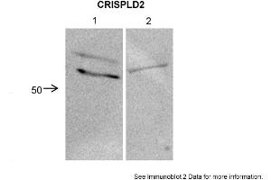 Sample Type: 1. (CRISPLD2 antibody  (N-Term))