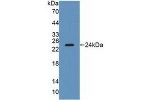 Detection of Recombinant LYPLA2, Human using Polyclonal Antibody to Lysophospholipase II (LYPLA2) (LYPLA2 antibody  (AA 1-196))