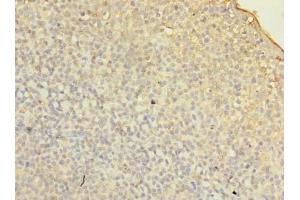 Immunohistochemistry of paraffin-embedded human tonsil tissue using ABIN7153114 at dilution of 1:100 (Formin-Like 1 antibody  (AA 207-457))
