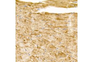 Immunohistochemistry of paraffin-embedded mouse heart using G1 Rabbit mAb (ABIN7265718) at dilution of 1:50 (40x lens).