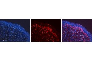 Rabbit Anti-NFE2L2 Antibody   Formalin Fixed Paraffin Embedded Tissue: Human Urinary Bladder Tissue Observed Staining: Cytoplasm, Nucleus Primary Antibody Concentration: 1:600 Other Working Concentrations: N/A Secondary Antibody: Donkey anti-Rabbit-Cy3 Secondary Antibody Concentration: 1:200 Magnification: 20X Exposure Time: 0. (NRF2 antibody  (N-Term))