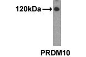 Western analysis of extracts from 293 cells using PRDM10 antibody. (PRDM10 antibody  (N-Term))