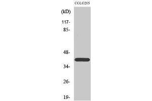 Western Blotting (WB) image for anti-Family with Sequence Similarity 203, Member B (FAM203B) (Internal Region) antibody (ABIN3183554) (FAM203B antibody  (Internal Region))