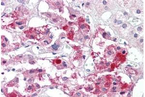 Anti-BAD antibody IHC staining of human adrenal. (BAD antibody  (AA 119-168))