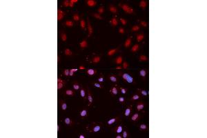 Immunofluorescence (IF) image for anti-Checkpoint Kinase 1 (CHEK1) (pSer280) antibody (ABIN1870069) (CHEK1 antibody  (pSer280))