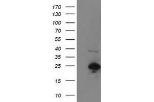 Image no. 1 for anti-Synovial Sarcoma, X Breakpoint 1 (SSX1) antibody (ABIN1501160)