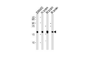 Western blot analysis of lysates from SW480 cell line, human brain, mouse brain and rat brain tissue lysate(from left to right), using VILIP1 Antibody at 1:1000 at each lane. (VSNL1 antibody  (C-Term))