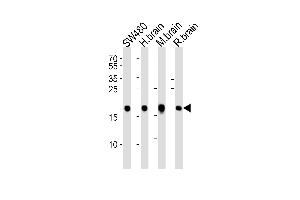 Western blot analysis of lysates from SW480 cell line, human brain, mouse brain and rat brain tissue lysate(from left to right), using VILIP1 Antibody at 1:1000 at each lane.