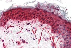 Anti-FZD3 / Frizzled 3 antibody  ABIN1048620 IHC staining of human skin. (FZD3 antibody  (N-Term))