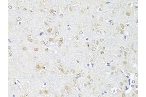 Immunohistochemistry of paraffin-embedded rat brain using RBFOX3 antibody (ABIN1874561) at dilution of 1:100 (40x lens). (NeuN antibody)