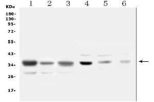 Western blot analysis of SFRP1 using anti-SFRP1 antibody (ABIN6719484). (SFRP1 antibody)
