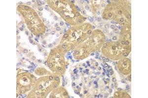 Immunohistochemistry of paraffin-embedded Rat kidney using AKR1A1 Polyclonal Antibody at dilution of 1:100 (40x lens). (AKR1A1 antibody)